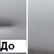 Устранение вмятин на коже фото