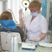 Удаление зубного камня ультразвуковым скалером фото