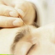 Консультация врача-невролога фото