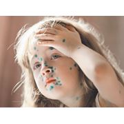 Бриллиантовый зелёный фото