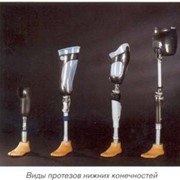 Изготовление протезов нижних,верхних конечностей фото