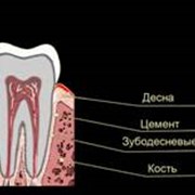 Пародонтология фото
