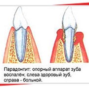 Пародонтология фото