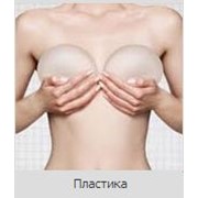 Коррекция груди улучшение формы фото