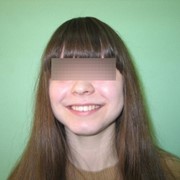 Пародонтологическое лечение фото