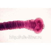 Ленточные черви в водопроводной воде г. Уфы фотография