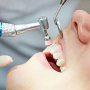 Профессиональная чистка зубов со скидкой 50% фотография