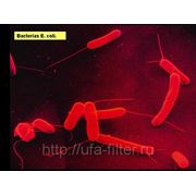 Опасная и смертоносная кишечная палочка Escherichia coli (E.coli) продолжается распространение в Европе. фотография