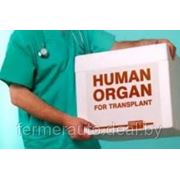 Трансплантация: кому нужнее орган? фотография
