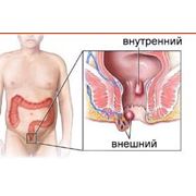 Консультация проктолога фотография