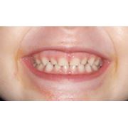 Детская стоматология фото