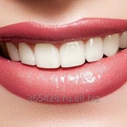 Установка виниров фото