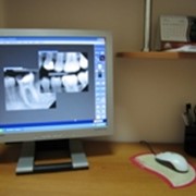 Рентгенологические исследования зубов фото
