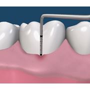 Пародонтологическое лечение