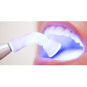 Отбеливание зубов лазерное фото