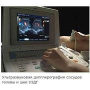 УЛЬТРАЗВУКОВАЯ ДОППЛЕРОГРАФИЯ СОСУДОВ ГОЛОВЫ И ШЕИ фото