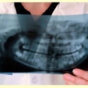 Ортопедическая стоматология фотография