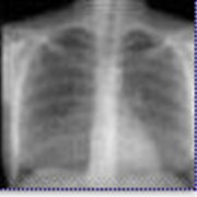 Пленка рентгеновская фотография