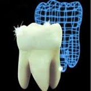 Ортопедическая стоматология фото