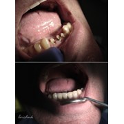 Эстетическая реставрация зубов. фотография