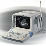 Сканеры ультразвуковые портативные.Портативная черно-белая ультразвуковая диагностическаясистема SonoScape SSI-600V