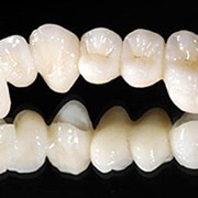 Протезирование зубов из диоксида циркония фото