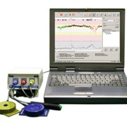 Фетальный монитор «Сономед-200» с автоматическим анализом КТГ