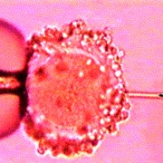 Инъекция сперматозоида в яйцеклетку (ИКСИ), Инъекция сперматозоида в яйцеклетку