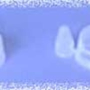 Крышка капельница полиэтиленовая боковая фото
