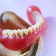 Протезирование зубов съемное