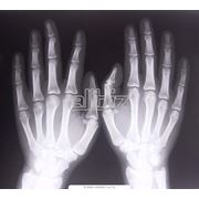 Рентгенодиагностика фото