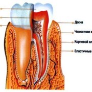 Лечение Гингивита в Киеве. Стоматология цена