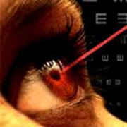 Лазерная коррекция зрения фото