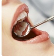 Удаление зубов. фотография