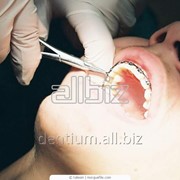 Стоматологические материалы Dentium (Южная Корея) фотография