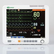 Электрокардиограф цифровой компьютерний БИОМЕД ECG-2000 фотография