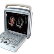 Портативная ультразвуковая кардиологическая диагностическая система CHISON Q6