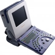 Портативный ультразвуковой сканер (УЗИ) ALOKA ProSound 2 фотография