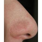 Средства для лечения заболеваний полости носа