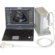 Система ультразвуковая диагностическая Echo Blacter фотография
