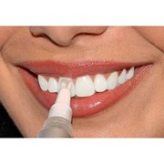 Карандаш для отбеливания зубов Luxury White Pro фото