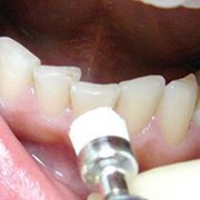 Лечение зубов по скорой помощи фото