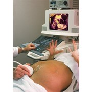Гинекологический осмотр беременных женщин.
