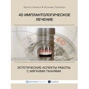 4D имплантологическое лечение:эстетические аспекты работы с мягкими тканями