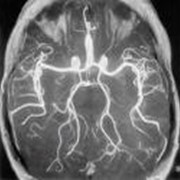 Магнитно-резонансная томография магистральных сосудов головы фото