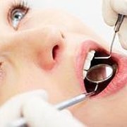 Терапевтическое лечение зубов фотография