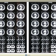 Медицинский светодиодный негатоскоп для 4-х рентгеновсих снимков фото