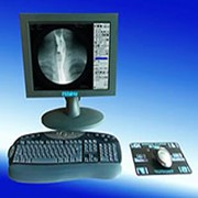 Аппарат X- Frame CCD цифровая система получения и обработки рентгеновских изображений, Italray s.r.i. фото