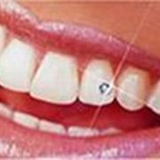 Скайсы - зубные украшения фотография