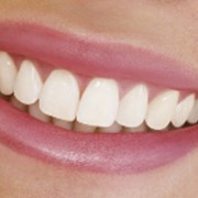 Несъемное протезирование зубов фото